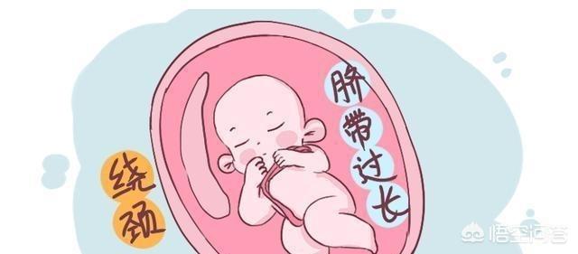 有谁知道快生产的孕妇肚子里孩子被脐带绕颈怎么办？