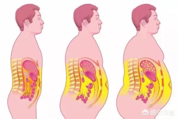 如何才能知道“内脏脂肪”多不多，如何减内脏脂肪？