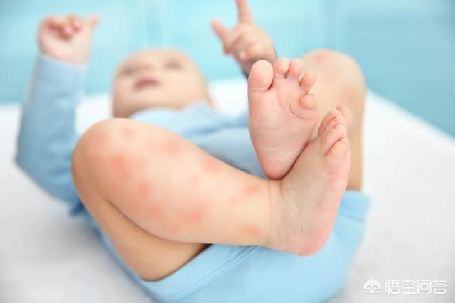 出生一个月的宝宝湿疹涂什么好？
